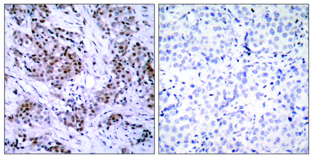 Anti-Estrogen Receptor-&#945; antibody produced in rabbit affinity isolated antibody