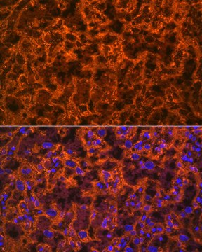 Anti-PLGF Antibody, clone 6N4V2, Rabbit Monoclonal