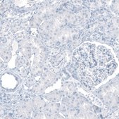 Monoclonal Anti-KRT20 antibody produced in mouse Prestige Antibodies® Powered by Atlas Antibodies, clone CL9390, purified immunoglobulin, buffered aqueous glycerol solution