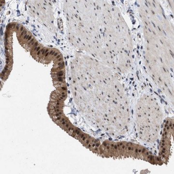 Anti-MKNK2 antibody produced in rabbit Prestige Antibodies&#174; Powered by Atlas Antibodies, affinity isolated antibody, buffered aqueous glycerol solution