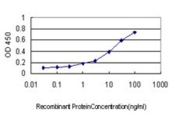 Monoclonal Anti-FHIT antibody produced in mouse clone 1C3, purified immunoglobulin, buffered aqueous solution