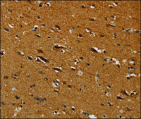Anti-CENPU antibody produced in rabbit affinity isolated antibody