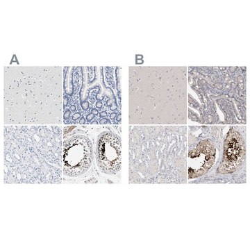 Anti-ACTL7B antibody produced in rabbit Prestige Antibodies&#174; Powered by Atlas Antibodies, affinity isolated antibody, buffered aqueous glycerol solution