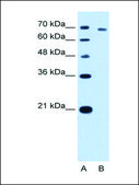 Anti-TARS antibody produced in rabbit IgG fraction of antiserum