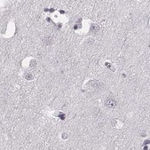 Anti-TCHHL1 antibody produced in rabbit Prestige Antibodies® Powered by Atlas Antibodies, affinity isolated antibody, buffered aqueous glycerol solution