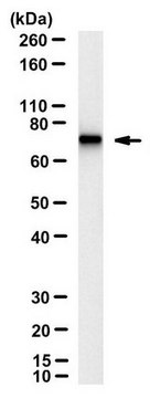 Anti-phospho-NFL (Ser473) Antibody, clone 4F8 clone 4F8, from mouse