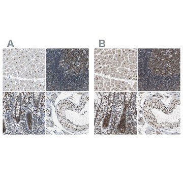 抗-USP28 兔抗 Ab1, Prestige Antibodies&#174; Powered by Atlas Antibodies, affinity isolated antibody, buffered aqueous glycerol solution