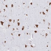 Anti-PRKRA antibody produced in rabbit Prestige Antibodies® Powered by Atlas Antibodies, affinity isolated antibody