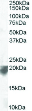 Anti-VPS29, C-Terminal antibody produced in goat affinity isolated antibody, buffered aqueous solution