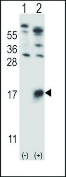 ANTI-GYPB (CENTER) antibody produced in rabbit IgG fraction of antiserum, buffered aqueous solution