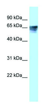 Anti-THRA antibody produced in rabbit affinity isolated antibody