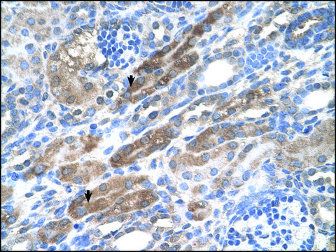 Anti-KIAA0319 antibody produced in rabbit IgG fraction of antiserum