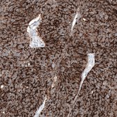 Anti-CLDN3 antibody produced in mouse Prestige Antibodies® Powered by Atlas Antibodies, clone CL13129, purified by using Protein A, buffered aqueous glycerol solution