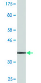 Monoclonal Anti-S100A9 antibody produced in mouse clone 4G9, purified immunoglobulin, buffered aqueous solution