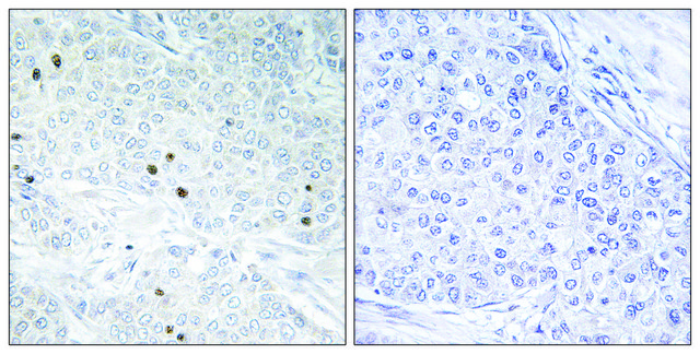 Anti-TP53INP2 antibody produced in rabbit affinity isolated antibody