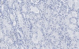 Anti-Claudin 6 Antibody, clone 1B22 ZooMAb® Rabbit Monoclonal recombinant, expressed in HEK 293 cells