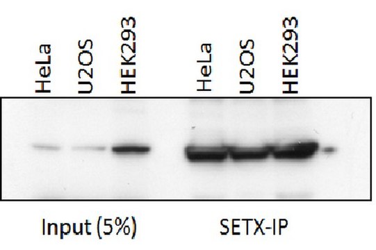 Anti-Senataxin (OY11) Antibody from rabbit, purified by affinity chromatography