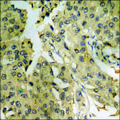 Anti-phospho-ZAP-70 (pTyr493) antibody produced in rabbit affinity isolated antibody
