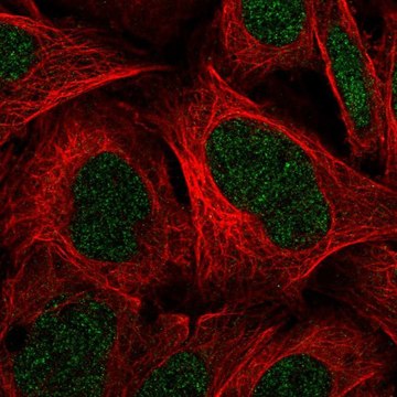 Anti-C11orf1 antibody produced in rabbit Prestige Antibodies&#174; Powered by Atlas Antibodies, affinity isolated antibody