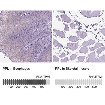 Anti-PPL antibody produced in rabbit Prestige Antibodies&#174; Powered by Atlas Antibodies, affinity isolated antibody, buffered aqueous glycerol solution