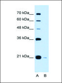 Anti-XTP3TPA (AB1) antibody produced in rabbit affinity isolated antibody