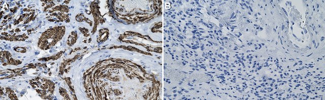 Anti-&#945; Actin 2 Antibody, clone 1C22 ZooMAb&#174; Rabbit Monoclonal recombinant, expressed in HEK 293 cells