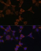 Anti-PRKAB1 antibody produced in rabbit