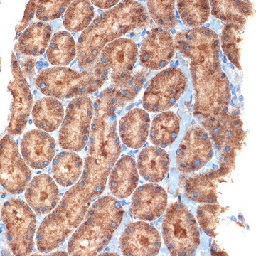 Anti-NEK6 antibody produced in rabbit