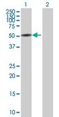 Anti-CTNNA3 antibody produced in mouse purified immunoglobulin, buffered aqueous solution