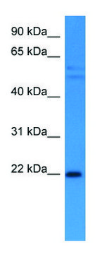 Anti-GADD45A (C-terminal) antibody produced in rabbit affinity isolated antibody