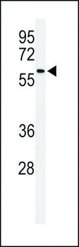 ANTI-SDR (CENTER) antibody produced in rabbit purified immunoglobulin, buffered aqueous solution