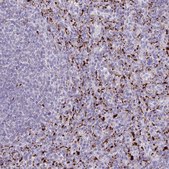 Anti-LIPA antibody produced in rabbit Prestige Antibodies® Powered by Atlas Antibodies, affinity isolated antibody, buffered aqueous glycerol solution