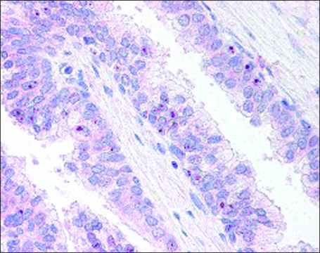 Anti-ERG antibody produced in goat affinity isolated antibody, buffered aqueous solution