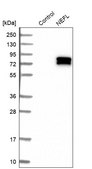 Anti-NEFL antibody produced in rabbit Prestige Antibodies® Powered by Atlas Antibodies, affinity isolated antibody, buffered aqueous glycerol solution