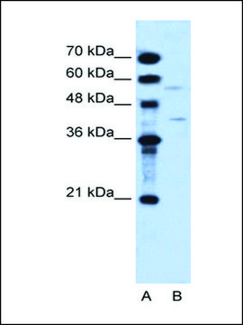 Anti-DHODH antibody produced in rabbit IgG fraction of antiserum