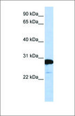 Anti-RANBP1 antibody produced in rabbit affinity isolated antibody