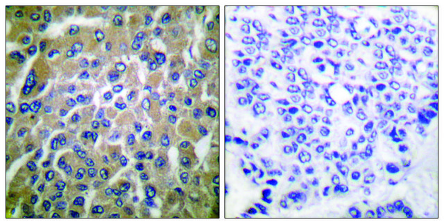 Anti-HCG &#946; antibody produced in rabbit affinity isolated antibody