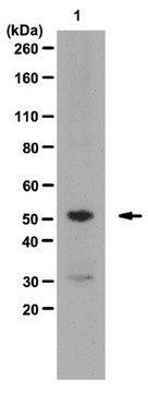 抗 KLF5（Krüppel 样因子 5）抗体 serum, from rabbit