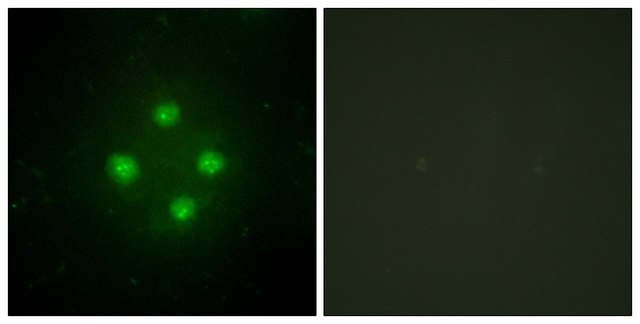 Anti-MED24 antibody produced in rabbit affinity isolated antibody