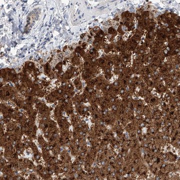 Anti-SLC22A7 antibody produced in rabbit Prestige Antibodies&#174; Powered by Atlas Antibodies, affinity isolated antibody, buffered aqueous glycerol solution