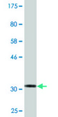 Monoclonal Anti-VAC14 antibody produced in mouse clone 3B2, purified immunoglobulin, buffered aqueous solution