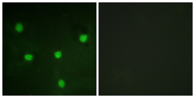 Anti-RBL1 antibody produced in rabbit affinity isolated antibody