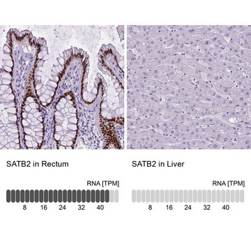 Monoclonal Anti-SATB2 antibody produced in mouse Prestige Antibodies&#174; Powered by Atlas Antibodies, clone CL0321, purified immunoglobulin, buffered aqueous glycerol solution