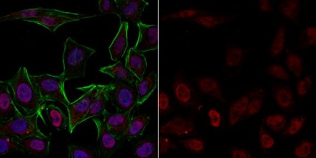 Anti-phospho-Histone H3 (Ser10) Antibody, clone 3H10, Alexa Fluor&#8482; 555 clone 3H10, from mouse, ALEXA FLUOR&#8482; 555