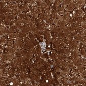 Anti-KYNU antibody produced in rabbit Prestige Antibodies® Powered by Atlas Antibodies, affinity isolated antibody, buffered aqueous glycerol solution