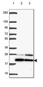 Anti-BTF3 antibody produced in rabbit Prestige Antibodies® Powered by Atlas Antibodies, affinity isolated antibody, buffered aqueous glycerol solution