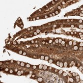 Anti-OTUD6B antibody produced in rabbit Prestige Antibodies® Powered by Atlas Antibodies, affinity isolated antibody, buffered aqueous glycerol solution, Ab1