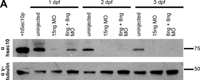 抗-&#947;-微管蛋白 兔抗 affinity isolated antibody, buffered aqueous solution