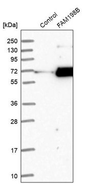 Anti-FAM198B antibody produced in rabbit Prestige Antibodies&#174; Powered by Atlas Antibodies, affinity isolated antibody, buffered aqueous glycerol solution