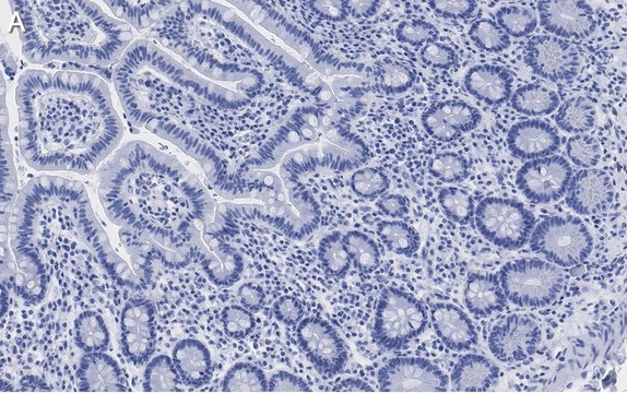 Anti-LONP1 Antibody, clone 1I18, ZooMAb&#174; Rabbit Monoclonal recombinant, expressed in HEK 293 cells